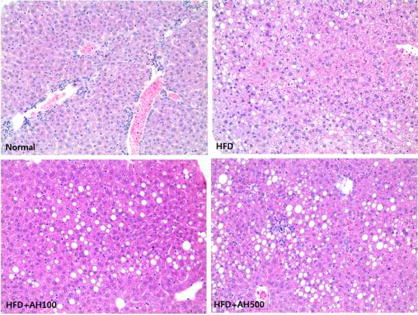 Liver tissue morphology in C57BL/6J mice fed high fat diet supplemented with extracts of Allium hookeri root for 8 weeks.