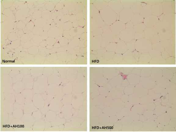 Fat tissue morphology in C57BL/6J mice fed high fat diet supplemented with extracts of Allium hookeri root for 8 weeks.