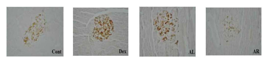 Photomicrograph showing insulin immunoreactive cells in islets of pancrease of diabetic mice(C57BLKS/J) fed experimental diets supplemented with cornstarch, dextrin, Leaf or root of A. Hookeri at 3% of diet for 8 weeks.