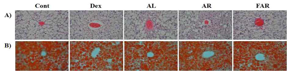 Comparison of histological change and fat accumulation in liver of diabetic mice fed experimental diets for 8 weeks