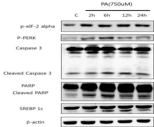 ER stress and apoptosis related protein expression in palmitic acid-induced HIT-T15 cells