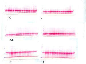 추출한 단백질의 농도 (ponceau staining)