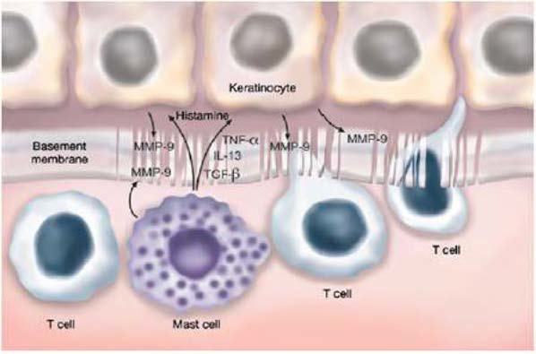 비만세포에 의한 각질형성세포의 염증반응 족진