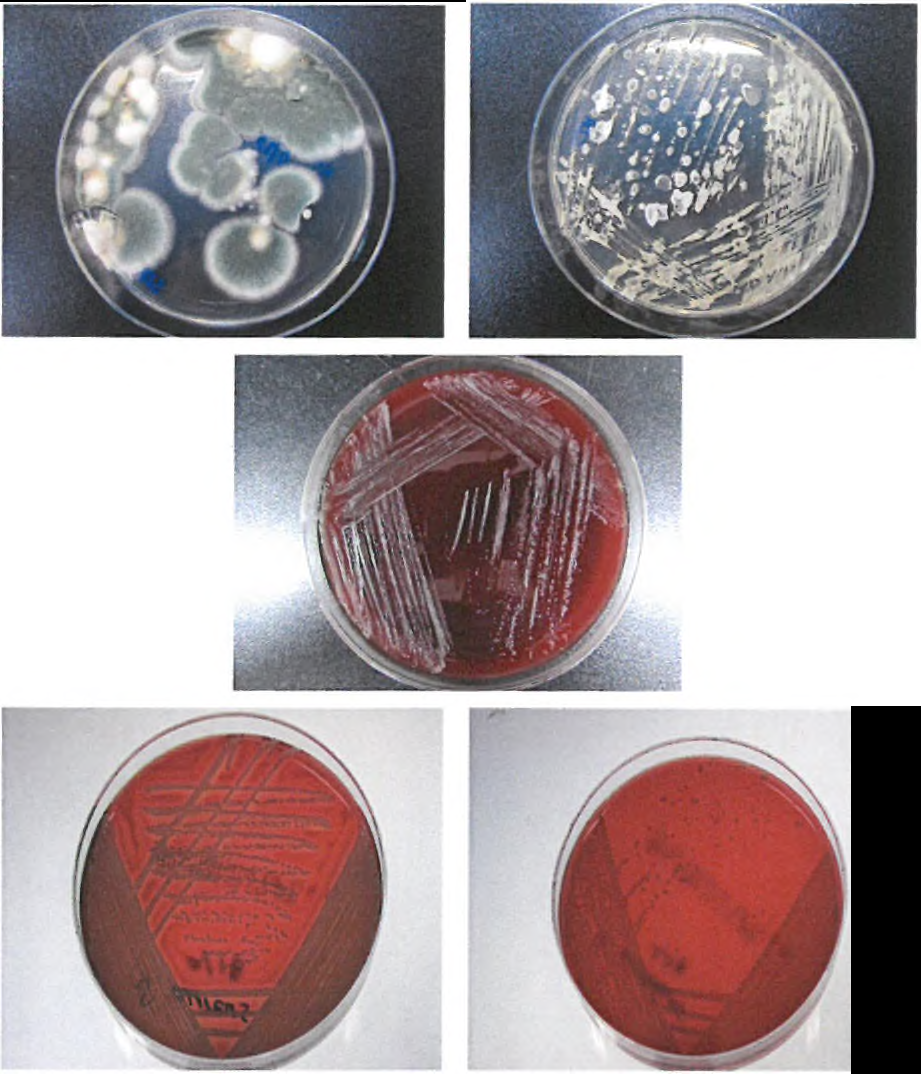 세균 배양 Trichophyton ruburum, Malassezia furfur, Candida albicans, Staphylococcus aureus. Streptococcus epidermidis)