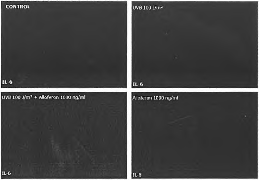 allofe「on처리에 의한 피부에서의 UVB에 대한 IL- 6 의 발현 양상