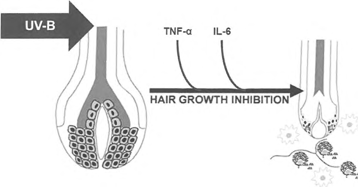 IL-6, TNF-a에 의한 모근 분화 억제