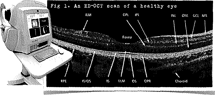 Optical Coherence Tomography(OCT) 측정법