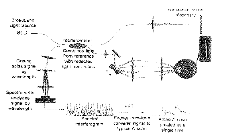 Oplical Coherence Tomography (OCT) 측정법