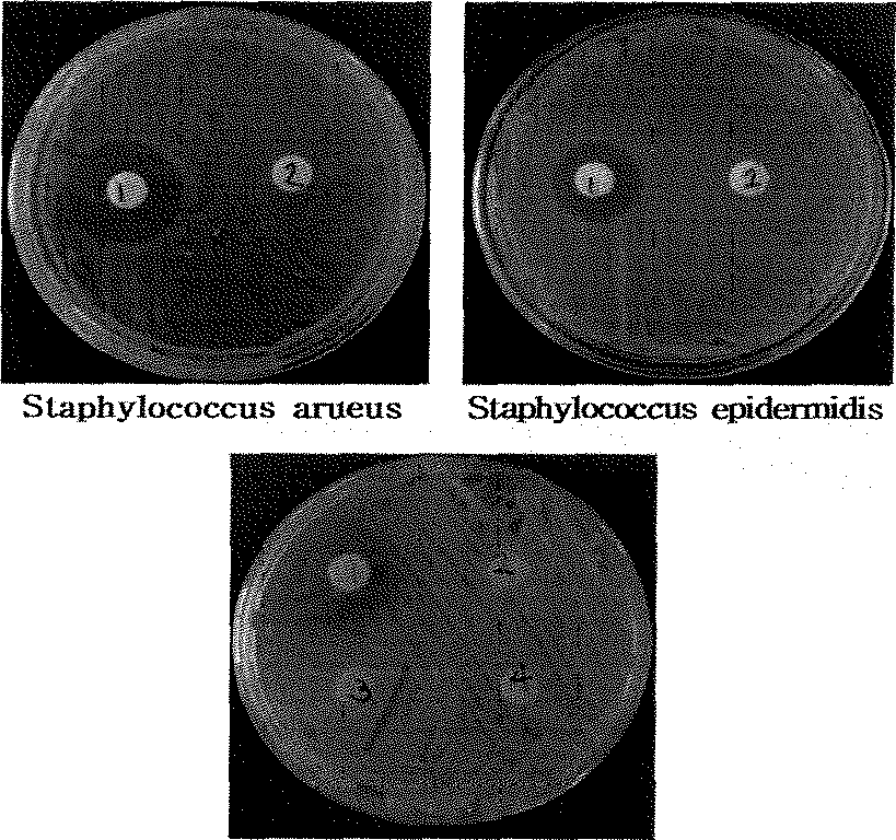 The inhibition zone of various bacteria against chlorogenic add