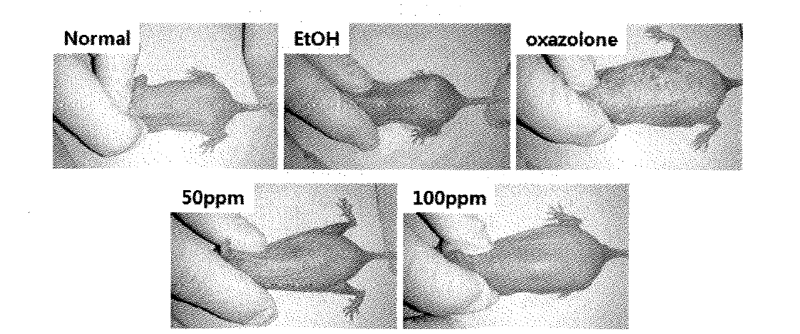 Hairless mouse 에서 접촉성 피부염에 대한 산딸기 잎 추출물의 효과