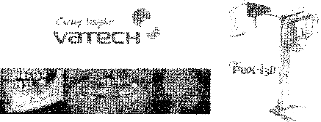 덴탈용 X-ray