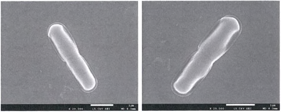 분리주 1의 전자현미경 사진(약 3~4 im)