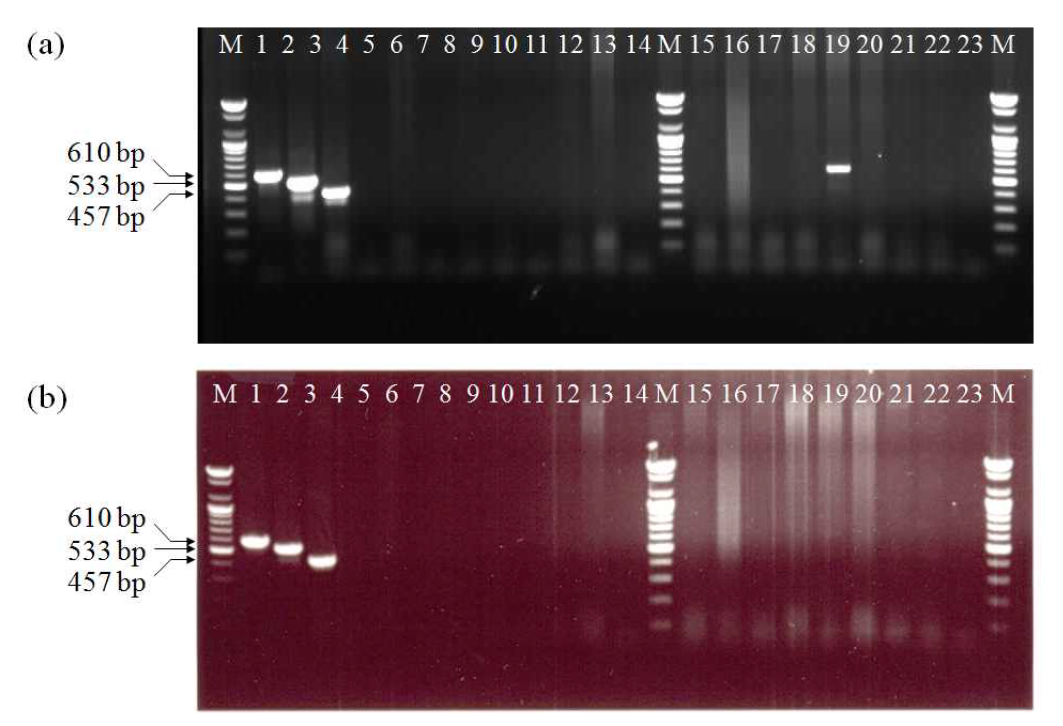 VH-4F, VH-7R, PD-1F, PD-1R, VI-F3와 VI-R1 프라이머를 이용한 multiplex-PCR 후 1.5% agarose gel 전기영동 분석