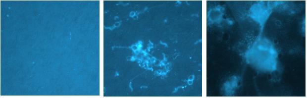 (좌)사육 초기의 사육수. DAPI 형광염색 현미경 사진(×1,000); (중앙) Biofloc 발달 중인 사육수; (우) Biofloc이 잘 발달된 사육수. 세균이 유기물과 결합하여 biofloc을 형성한다.