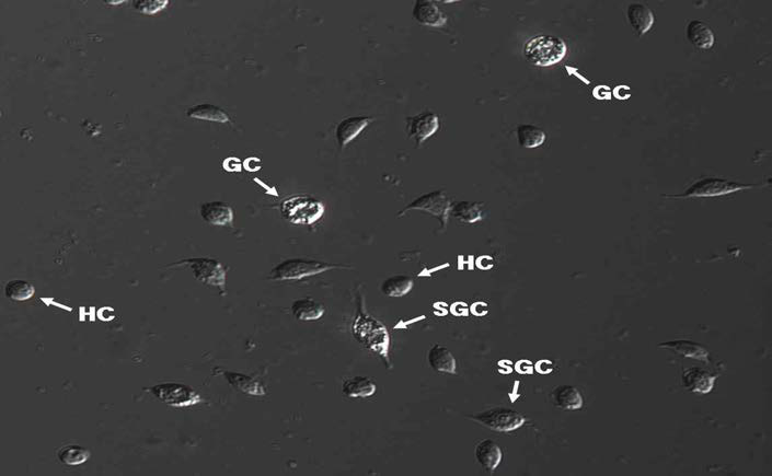 위상차 현미경에 의한 헤모사이트의 사진, GC: granular cell; HC: hyaline cell; SGC: semigranular cell.