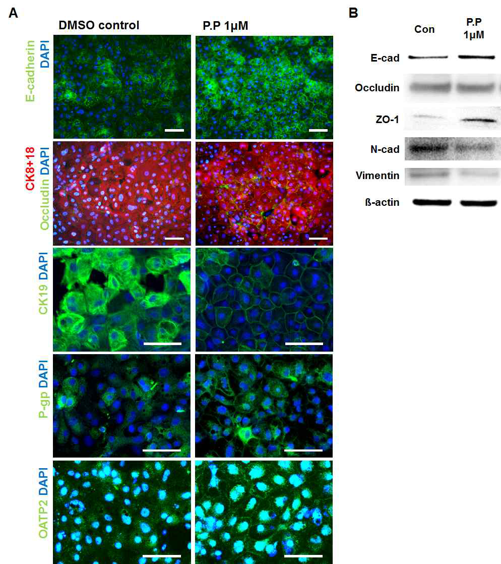 PP에 의한 세포극성마커와 EMT 관련 마커의 변화
