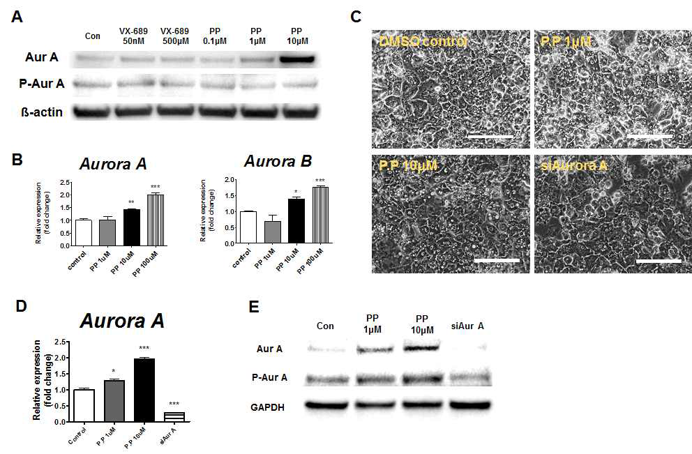 PP 처리에 의한 Aurora kinase A발현 분석시험.