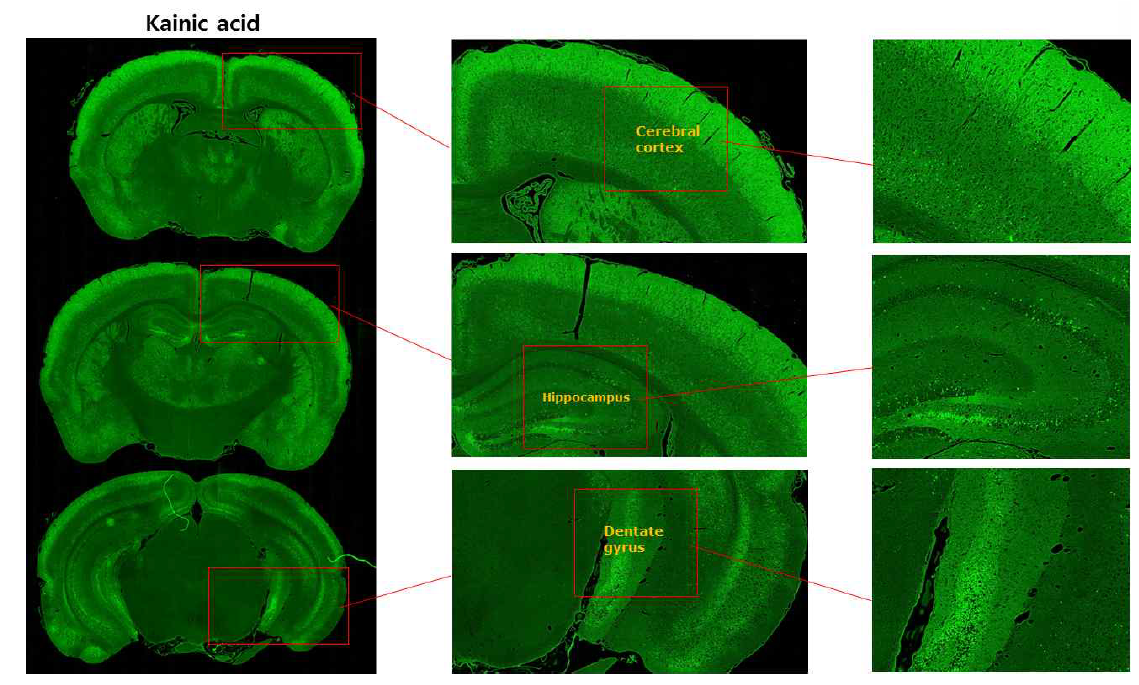 GFAP-luc 형질전환마우스 KA 투여군 뇌조직 FJC 염색결과