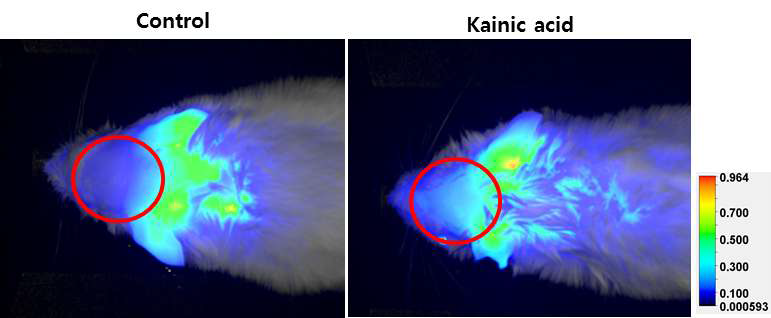 GFAP-luc 형질전환마우스 대조군, KA 투여군의 확대된 형광이미지