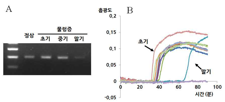 PCR (A)과 LAMP 반응(B)을 이용한 초기, 중기, 말기의 물렁증 감염 멍게에 있어서 미동정 바이러스 (E-17)의 발현양상의 비교