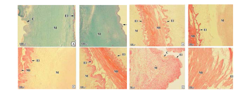 멍게의 물렁증 단계에 따른 수관의 조직학적 변화. (좌) A: Stage-O, B-D: Stage-1. C, cuticle (큐티클층); El, epidermal layer (상피층); M, matrix (기질); Ml, muscle layer (근육층). (우) A-B: Stage-2, C-D: Stage-3