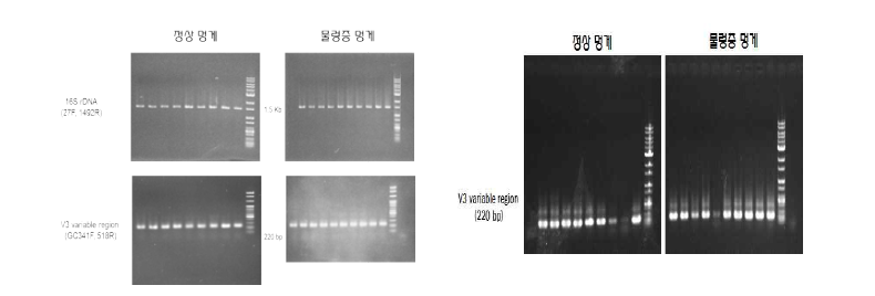채집된 정상 및 물렁증 멍게의 Bacterial gDNA로 16S rDNA 및 V3 variable region gene의 PCR 산물(좌) 2월, (우) 4월