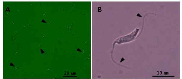 물렁증 멍게에서 분리된 편모충 (A)과 확대된 모습 (B)