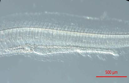 치삼사료를 공급한 뱀장어 자어의 소화기관 사진.