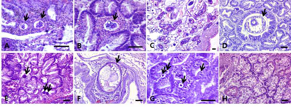 Histological sections of Manila clam infected by parasite (H%E). A: Perkinsus olseni in gill tissue, B: Perkinsus olseni in digestive gland, C: Trematode, D: Copepod, E: Rickettsia-like organisms, F: Metacestode, G: Unknown bacteria, H: Erosion, Scale bar: 50 μm