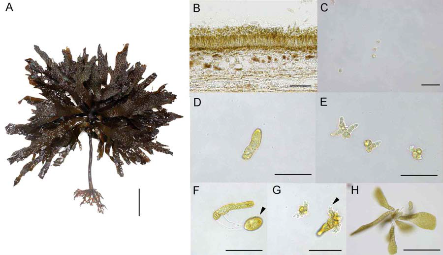 Development of Ecklonia kurome. A: Mature thalli. B: Cross-sectioned sori. C: Germling after 1 day of zoospore release. D: Female gametophyte after 3 days culture. E: Male gametophyte after 3 days culture. F: Oogonia formation (arrow head) from a female gametophyte after 10 days culture. G: Spermatia formation (arrow head) of a male gametophyte after 10 days culture. H: Micro-sporophyte after 30 days culture. Scale bars 10 cm(A), 50 ㎛ (B-H), 200 ㎛ (H). Culture conditions are 15℃, 20 μmolm-2·s-1, 10:14(L:D)