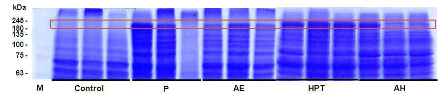 Electrophoresis results of muscle in flounder