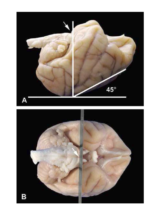 (A) 고정된 뇌를 윗 방향이 아랫면으로 가도록 두고 바닥면과 45〬 를 되도록한 후, 표지점인 교뇌 앞 부분을 사용한다. (B) 뇌는 교뇌 가장 앞면에서 횡단면으로 절개 한다.