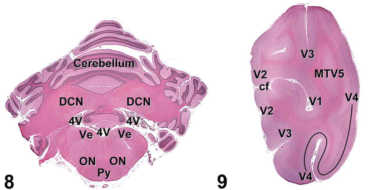 Cynomolgus monkey 소뇌의 H ON, olivary nuclei; Py, pyramidal tracts; V4, fourth ventricle; Ve, vestibular nuclei.