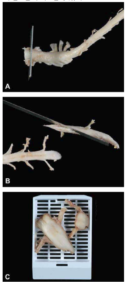 (A) 포르말린에 고정된 척수를 C1-C2에서 횡단면으로 절개한다. (B) 포르말린에 고정된 척수를 T11-T12에서 비스듬히 절개한다. (C) C1-C2의 횡 단면과 비스듬히 절개되어 고정된 척수. 사진에서는 절단면의 앞쪽을 보여주고 있지만, 포매시에는 아래를 향하도록 한다.