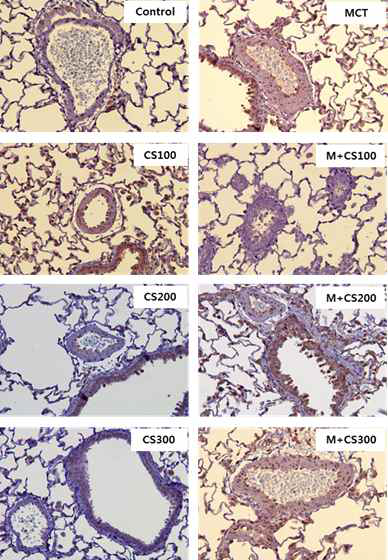 Histopathology