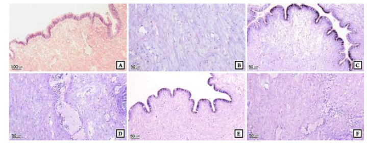 Histological alteration of foot of ablaone in high temperature.