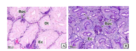 Photomicroscopical characteristic of hepatopacreas of abalone.