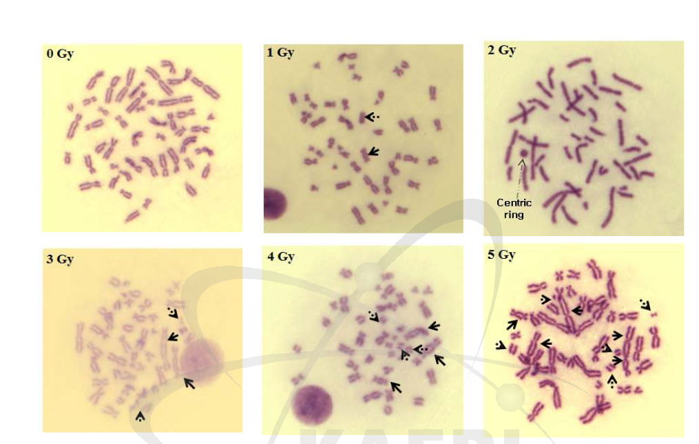 The representative pictures of metaphase lymphocytes after irradiated with 0 - 5 Gy gamma rays at 1,000 magnification. Solid arrows are dicentric chromosomes and dotted arrows are acentric fragments.