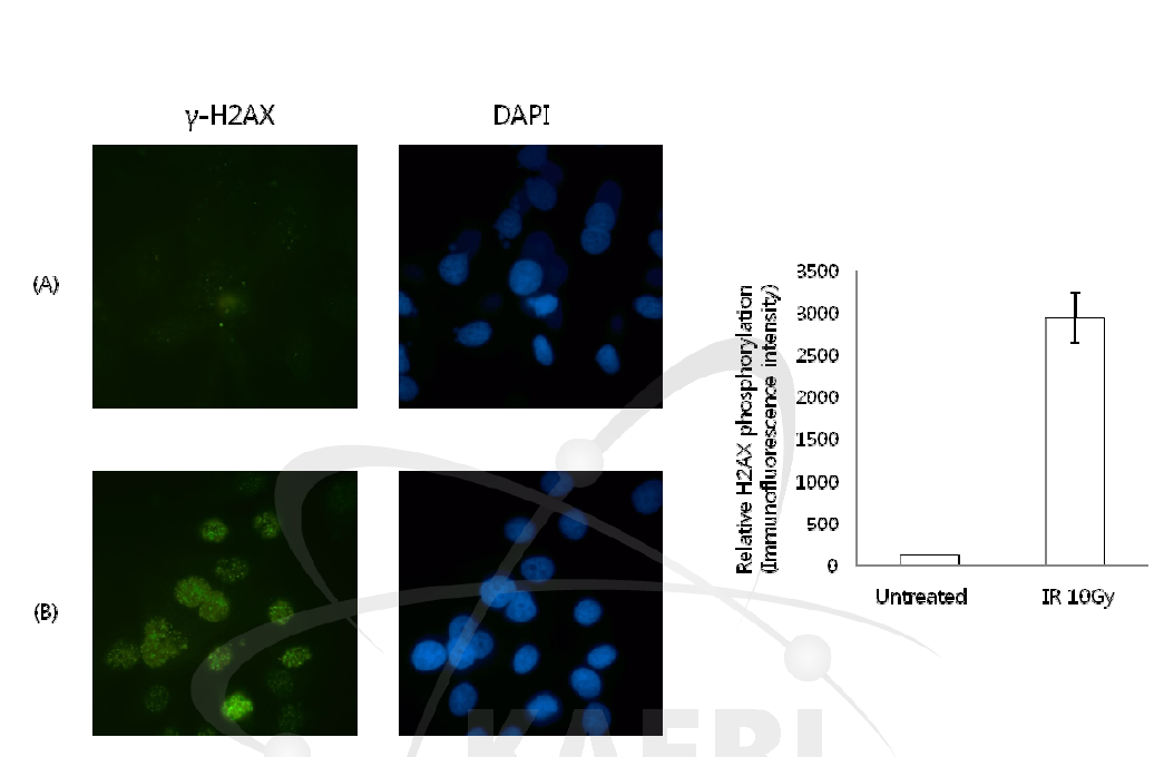 Repregentative image of MCF-7 cells irradiated with 10 Gy gamma-rays at 1,000 fold magnification: (A) Untreated control, (B) γ-H2AX foci formation at 2 h post-irradiation. Relative H2AX phosphorylation intensity was calculated by ImagePartner 4.0 software.