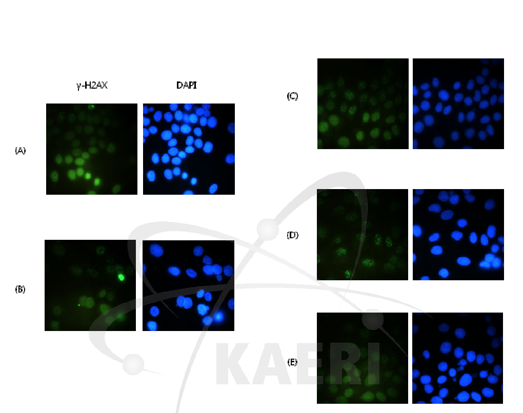 γ-H2AX foci formation in MCF-7 cell after 1 Gy gamma-rays irradiation: (A) 0, (B) 15 min, (C) 1 h, (D) 2 h and (E) 24 h after irradiation.