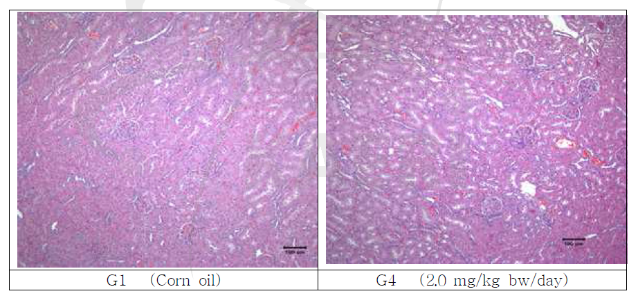2-dDCB의 아급성 독성 평가 결과(랫트의 신장 조직 사진)