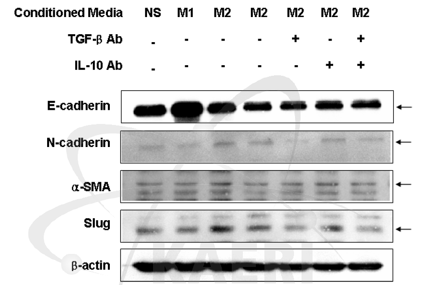 M2 macrophage에 의해 분비되는 TGF-β/IL-10 억제를 통한 폐 상피세포(M LE12)의 이상분화 제어