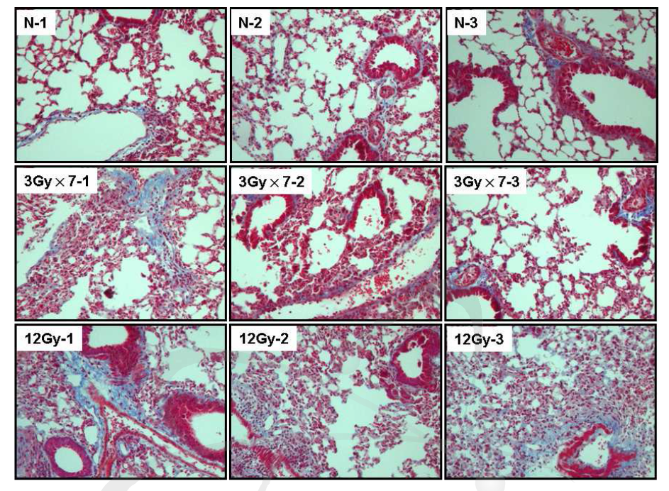 방사선 조사 방법에 따른 폐 조직내 collagen 축적 차이. 방사선 흉부조사 후 6개월째 수행함.