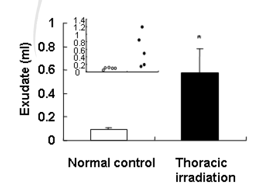 흉부 방사선 조사 (14Gy, 0.6Gy/min) 후 6개월째 생쥐의폐 삼출액 측정. (n=5마리)