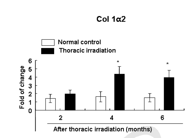 흉부 방사선 조사 후 경과 기간별 폐 조직내 발현하는 collagen