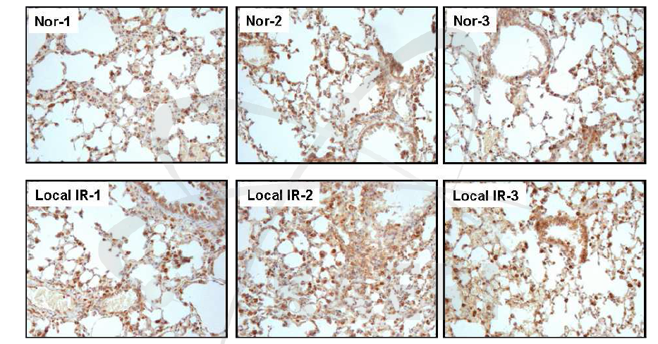 방사선 조사 후 2개월째 폐 조직 내 유입된 Mac-3 positive macrophage 분석.