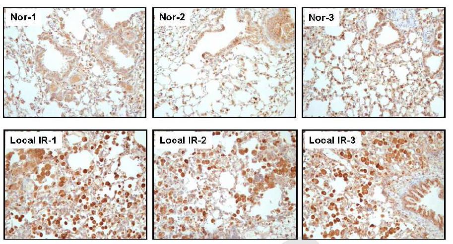 방사선 조사 후 4개월째 폐 조직 내 유입된 Mac-3 positive macrophage 분석.