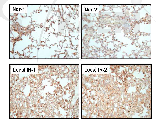 방사선 조사 후 6개월째 폐 조직 내 유입된 Mac-3 positive macrophage 분석.