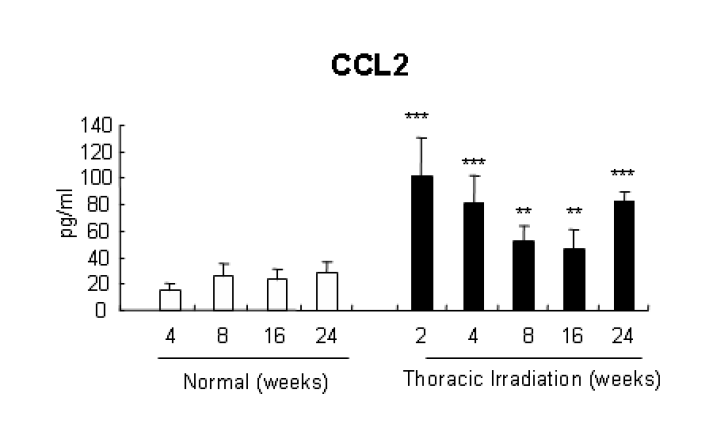 흉부 방사선 조사 후 경과 기간별 폐 조직내 CCL2 단백질 비교검증. n=5∼6마리.***p< 0.01, **p< 0.05