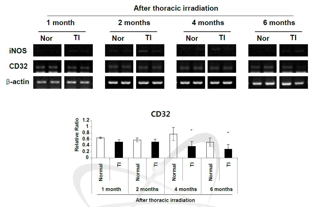 흉부 방사선 조사 후 경과 기간별 폐 조직내로 유입된 대식세포의 M 1 marker (iNOS와 CD32)의 mRNA 발현 비교. n=5∼6마리